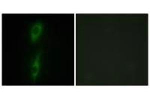 Immunofluorescence analysis of HeLa cells, using ACVL1 antibody. (ACVRL1 anticorps)