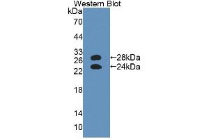 Western blot analysis of the recombinant protein. (ORM1 anticorps  (AA 19-207))