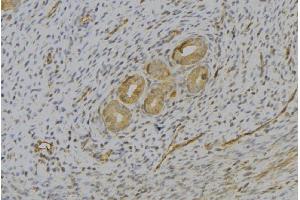 ABIN6277074 at 1/100 staining Human uterus tissue by IHC-P.