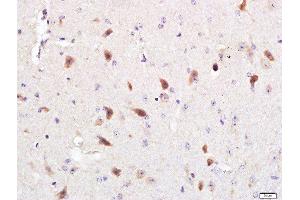 Paraformaldehyde-fixed, paraffin embedded mouse brain, Antigen retrieval by boiling in sodium citrate buffer (pH6.