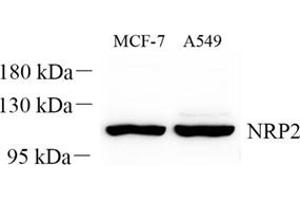 Western blot analysis of NRP2 (ABIN7074826) at dilution of 1: 300 (NRP2 anticorps)