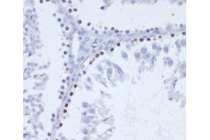 Immunohistochemistry of paraffin-embedded Rat testis using Phospho-γH2A. (gamma H2AX anticorps  (pSer139))