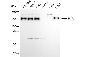 Western blotting analysis using BCR antibody (ABIN7797789).