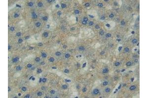 Detection of FAK in Human Liver cancer Tissue using Polyclonal Antibody to Focal Adhesion Kinase (FAK)