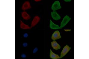ABIN7097113 and ABIN7101180 staining Hela cells(30 min of UV treatment) by IF/ICC. (LRRC3B anticorps)