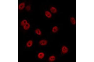 ABIN6274073 staining K562 by IF/ICC. (CDKN1C anticorps  (C-Term))