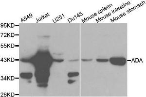 Western blot analysis of extracts of various cell lines, using ADA antibody. (ADA anticorps  (AA 1-363))