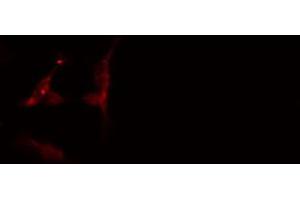 ABIN6274575 staining 293 cells by IF/ICC.