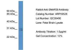 WB Suggested Anti-SNAP29  Antibody Titration: 0. (SNAP29 anticorps  (Middle Region))