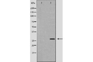 Western blot analysis of extracts of SH-SY5Y  , using BDNF antibody. (BDNF anticorps  (Internal Region))
