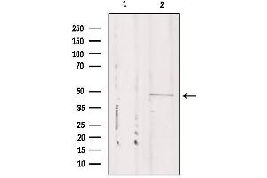 Western blot analysis of extracts from Mouse cancer, using CSTF1 Antibody. (CSTF1 anticorps  (N-Term))