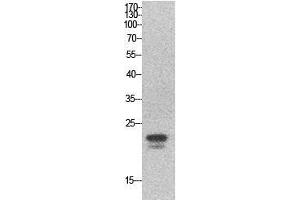 Western Blot (WB) analysis of HeLa cells using SRY Polyclonal Antibody. (SRY anticorps  (Internal Region))