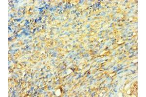 Immunohistochemistry of paraffin-embedded human tonsil tissue using ABIN7175904 at dilution of 1:100 (XRCC5 anticorps  (AA 543-732))