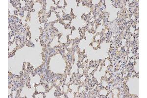 Immunohistochemistry (IHC) image for anti-Baculoviral IAP Repeat-Containing 5 (BIRC5) antibody (ABIN1875407)