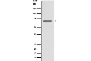 Western blot analysis of beta 2 Adrenergic Receptor expression in A431 cell lysate.