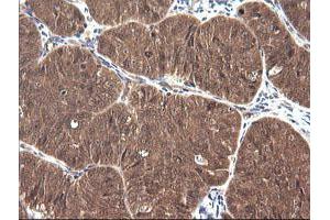 Image no. 2 for anti-Cancer/testis Antigen 1B (CTAG1B) antibody (ABIN1499895) (CTAG1B anticorps)