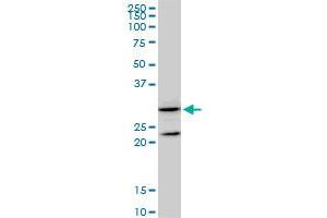 GSTZ1 monoclonal antibody (M01), clone 1G12. (GSTZ1 anticorps  (AA 109-216))