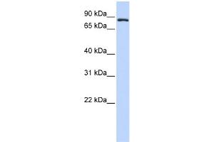 WB Suggested Anti-TFR2 Antibody Titration:  0. (Transferrin Receptor 2 anticorps  (Middle Region))