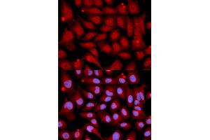 Immunofluorescence analysis of U2OS cells using MAP2K6 antibody. (MAP2K6 anticorps)