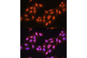 Immunofluorescence analysis of U-2 OS cells using PRMT5 Rabbit pAb (ABIN3022065, ABIN3022066, ABIN3022067 and ABIN6218592) at dilution of 100 (40x lens).
