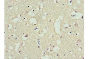 Immunohistochemistry of paraffin-embedded human brain tissue using ABIN7151243 at dilution of 1:100 (TRIM13 anticorps  (AA 40-310))