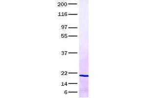 Validation with Western Blot