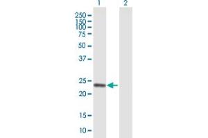 Western Blot analysis of COMT expression in transfected 293T cell line by COMT MaxPab polyclonal antibody.