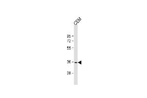 Anti-RN Antibody (Center) at 1:2000 dilution + CEM whole cell lysate Lysates/proteins at 20 μg per lane. (RNF126 anticorps  (AA 84-115))