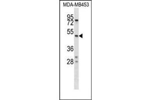 Western blot analysis of SERPINA5 Antibody (N-term) Cat. (SERPINA5 anticorps  (N-Term))