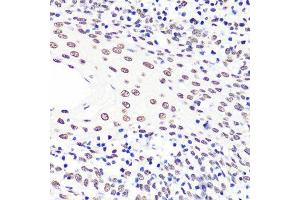 Immunohistochemistry of paraffin-embedded human tonsil using H3K36me2 antibody.