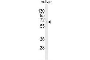 Western blot analysis in mouse liver tissue lysates (35ug/lane) using KY Antibody (N-term).