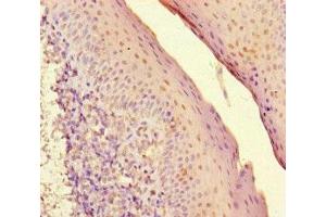 Immunohistochemistry of paraffin-embedded human tonsil tissue using ABIN7155525 at dilution of 1:100 (SUV39H1 anticorps  (AA 179-412))