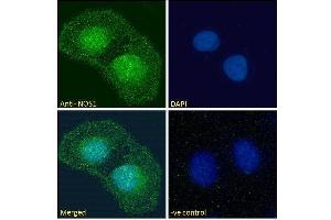 ABIN184662 Immunofluorescence analysis of paraformaldehyde fixed U2OS cells, permeabilized with 0.