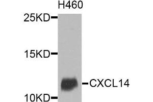 Western blot analysis of extracts of various cells, using CXCL14 antibody. (CXCL14 anticorps)