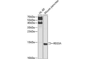 Western blot analysis of extracts of various cell lines, using REG3A antibody (ABIN6132545, ABIN6146855, ABIN6146856 and ABIN6216122) at 1:1000 dilution. (REG3A anticorps  (AA 27-175))