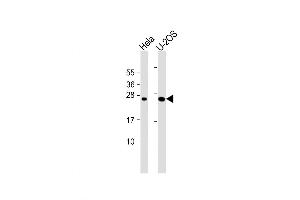 Western Blot at 1:1000 dilution Lane 1: Hela whole cell lysate Lane 2: U-2OS whole cell lysate Lysates/proteins at 20 ug per lane. (DCTN6 anticorps  (AA 53-80))