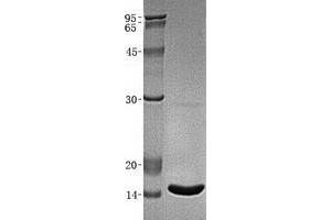 Validation with Western Blot (beta-2 Microglobulin Protéine)