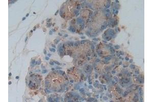Detection of CTSL in Rat Pancreas Tissue using Polyclonal Antibody to Cathepsin L (CTSL)