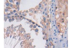 DAB staining on IHC-P; Samples: Rat Testis Tissue (PF4 anticorps  (AA 30-105))