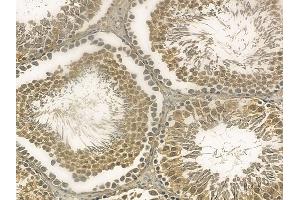 LCHN Mouse Monoclonal Antibody at 1/100 staining rat testis tissue by IHC-P. (DENND11/KIAA1147 anticorps)