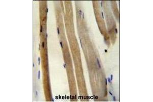 CS Antibody (N-term) (ABIN652074 and ABIN2840538) immunohistochemistry analysis in formalin fixed and paraffin embedded human skeletal muscle followed by peroxidase conjugation of the secondary antibody and DAB staining. (CS (AA 27-55), (N-Term) anticorps)