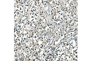 IHC analysis of ATP5H using anti-ATP5H antibody (ABIN7600467).