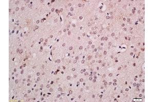 Formalin-fixed and paraffin embedded rat brain labeled with Anti-FOXB1 Polyclonal Antibody, Unconjugated  at 1:200 followed by conjugation to the secondary antibody and DAB staining. (FOXB1 anticorps  (AA 1-100))