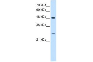 WB Suggested Anti-SH3BGR Antibody Titration:  0. (SH3BGR anticorps  (N-Term))