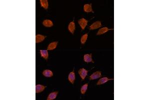 Immunofluorescence analysis of L929 cells using IPO8 antibody (ABIN7267859) at dilution of 1:100.