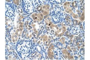 CBS antibody was used for immunohistochemistry at a concentration of 4-8 ug/ml to stain Epithelial cells of renal tubule (arrows) in Human Kidney. (CBS anticorps  (N-Term))
