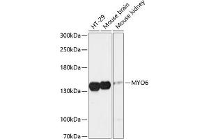 Western blot analysis of extracts of various cell lines, using MYO6 antibody (ABIN6129617, ABIN6144291, ABIN6144292 and ABIN6216869) at 1:3000 dilution. (Myosin VI anticorps  (AA 1016-1285))