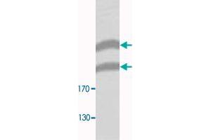 Western blot analysis of HeLa membrane fraction lysate with PLXNB1 polyclonal antibody  at 1 : 300 dilution. (PLXNB1 anticorps  (N-Term))