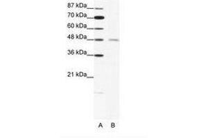 Image no. 1 for anti-Cholinergic Receptor, Nicotinic, delta (Muscle) (CHRND) (N-Term) antibody (ABIN202701) (CHRND anticorps  (N-Term))