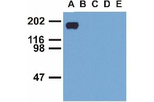 Western blotting analysis of EGFR (phospho-Tyr992) by mouse monoclonal antibody EM-12 inEGF-treated A431 (A), CALU-3 (B), MCF-7 (C), Jurkat (D) and Ramos (E) cell lines (reduced conditions). (EGFR anticorps  (Tyr992))